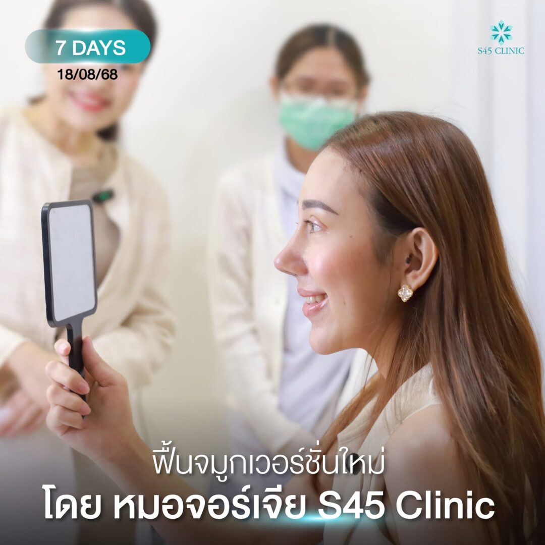 จมูกเรียวสวย