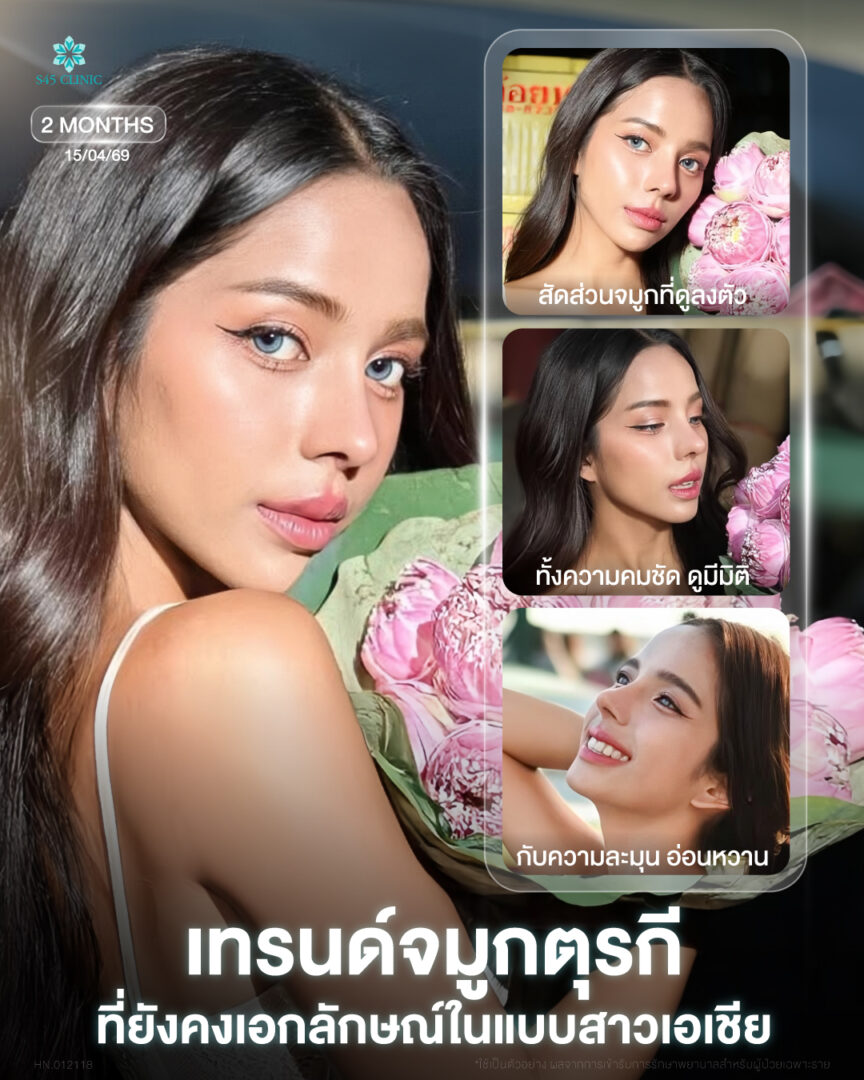 ทรงจทูกตุรกี 01