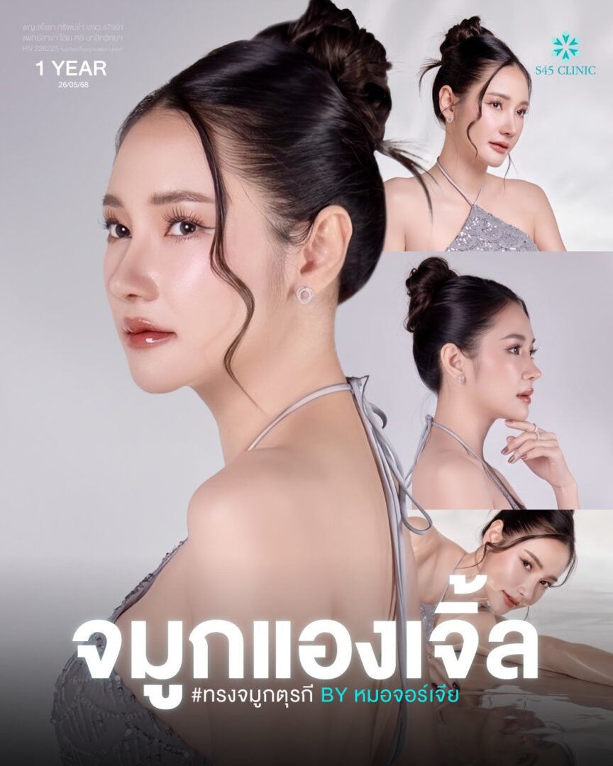ทรงจทูกตุรกี 02
