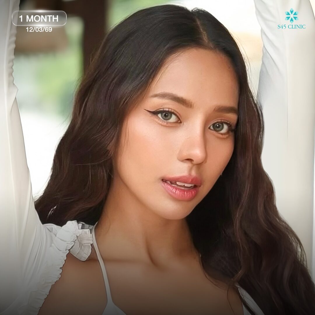 ทรงจทูกตุรกี 06