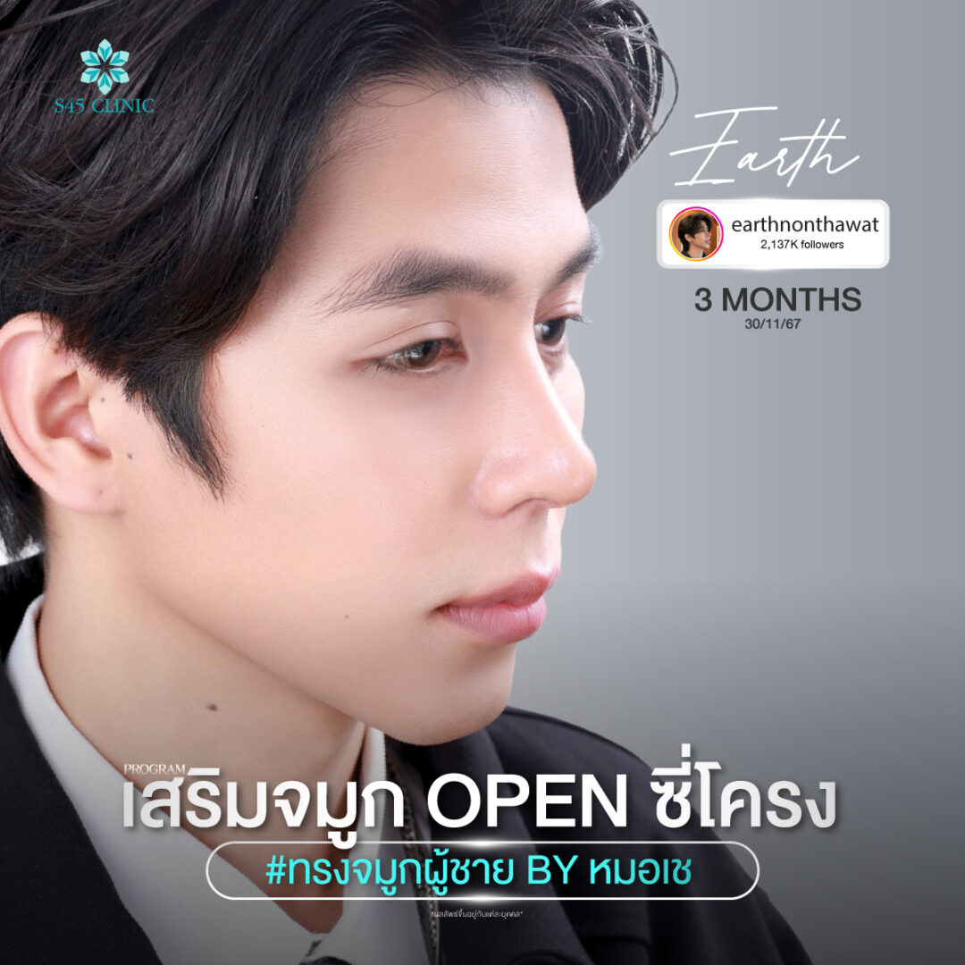 ทรงจมูกผู้ชาย