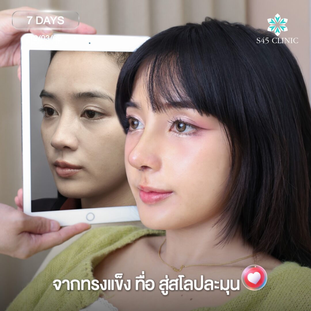 ทรงละมุน