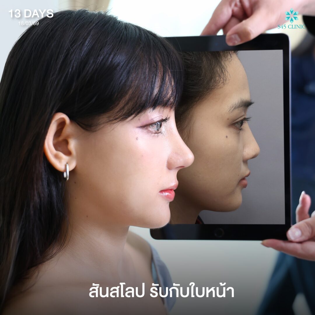 ทรงสโลปรับกับใบหน้า