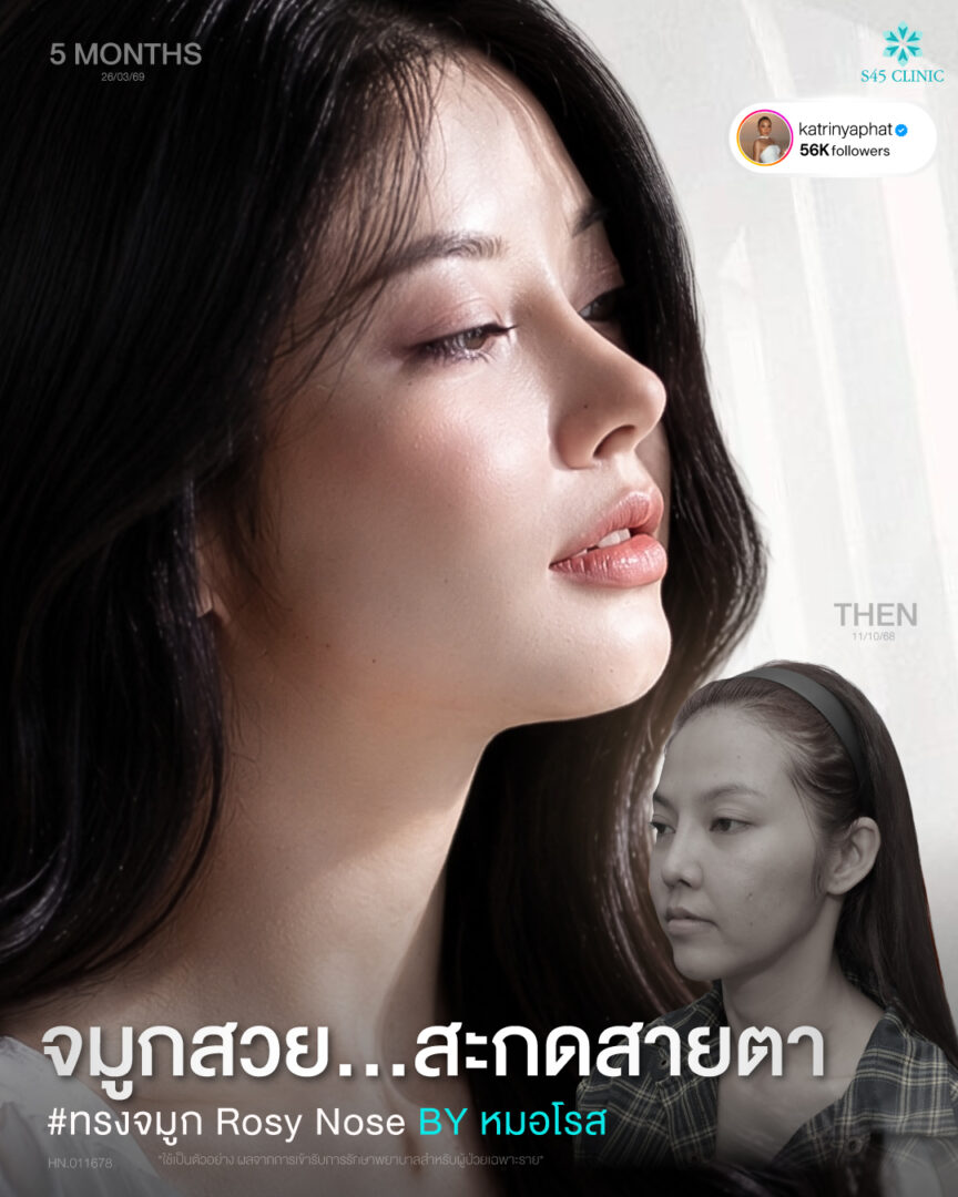 ทรงสโลปหวาน
