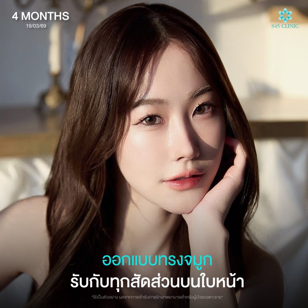 ปรึกษาแพทย์ก่อนเสริมจมูก 08