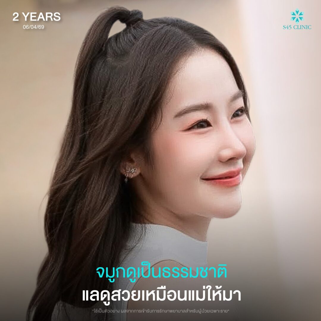 ปรึกษาแพทย์ก่อนเสริมจมูก 09