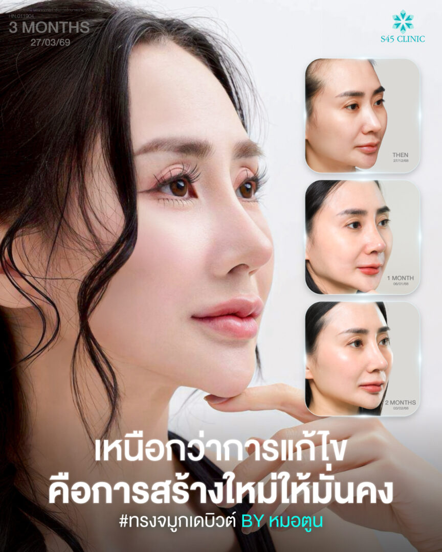 โครงสร้างจมูก 01