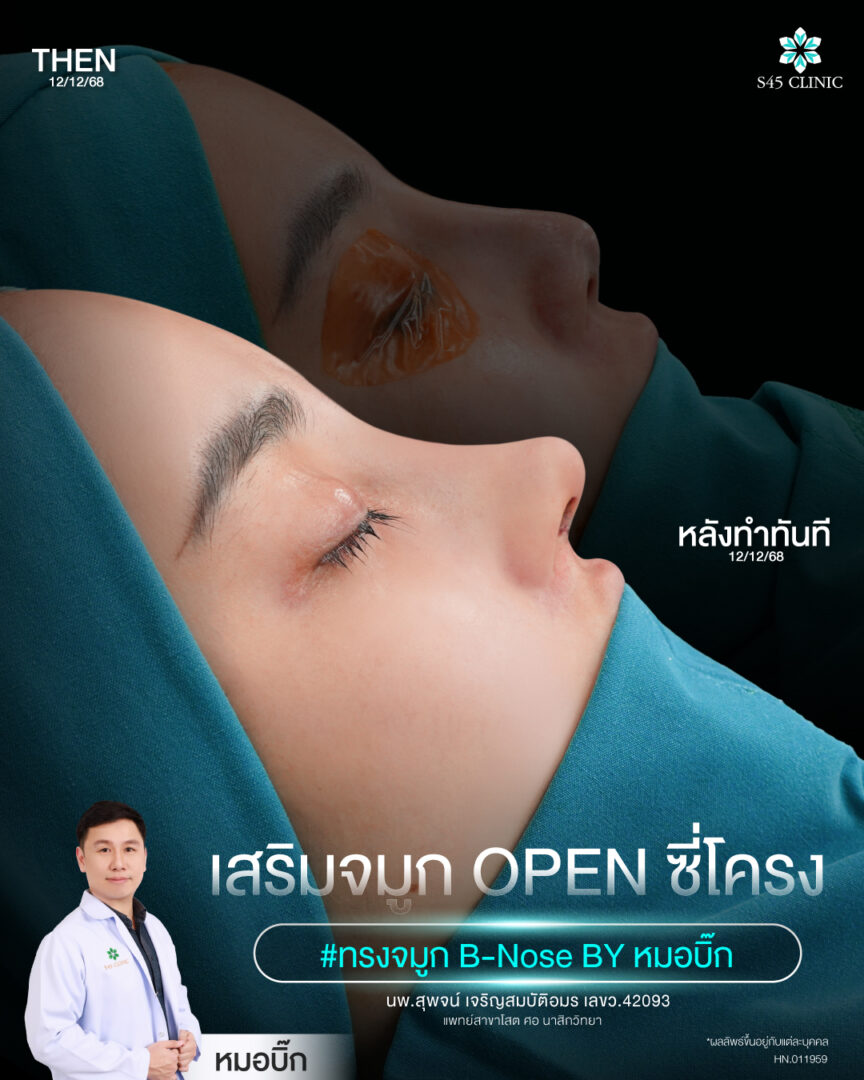 โครงสร้างจมูก 02