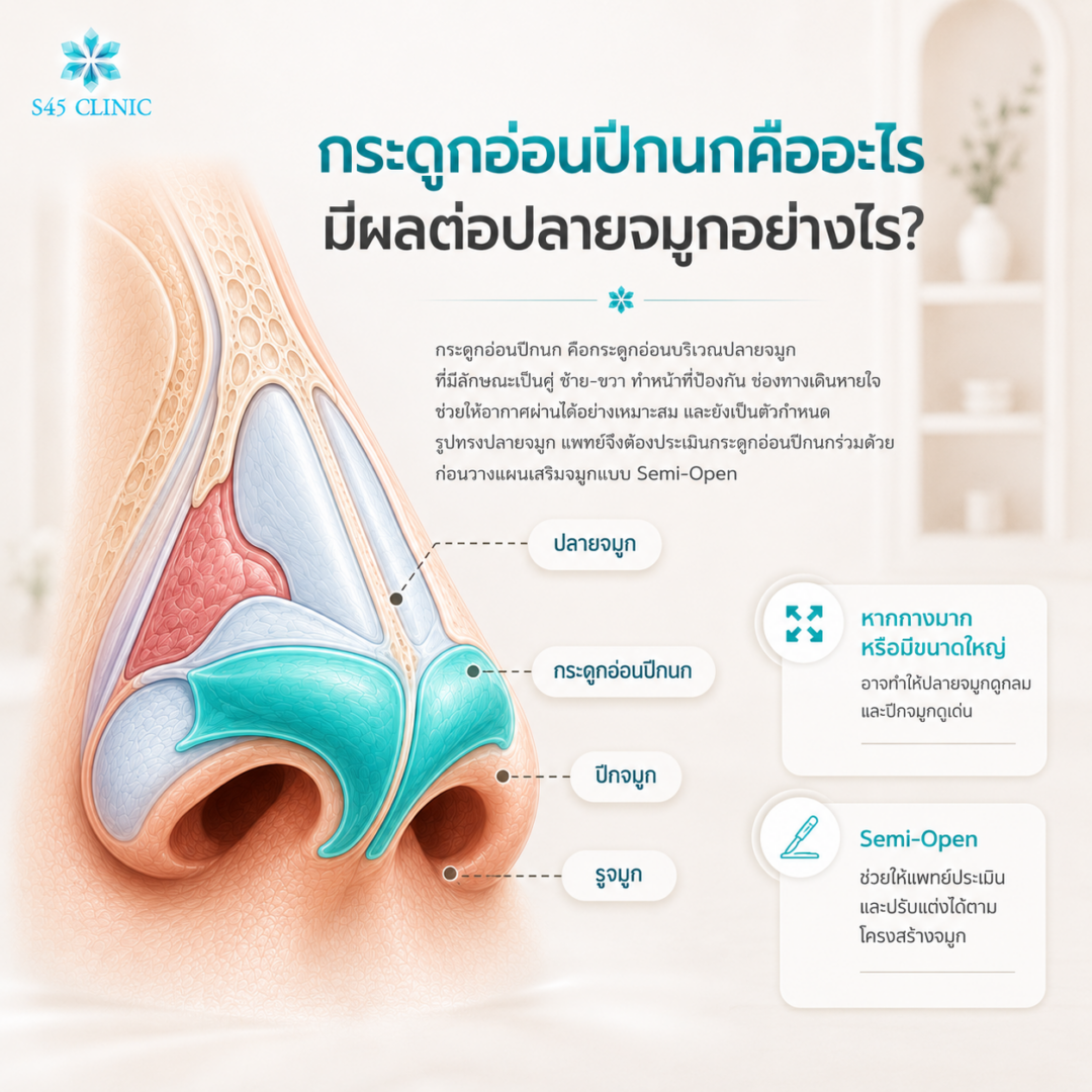 เสริมจมูก Semi-Open สามารถปรับส่วนไหนได้บ้าง? รู้ไว้ก่อนเลือกเทคนิคให้เหมาะกับโครงสร้างจมูก 3 โครงสร้างจมูก 05