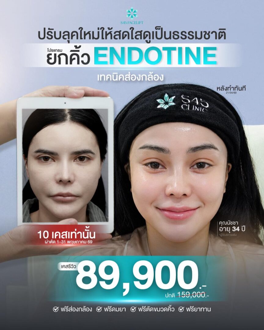 Promotion โปรโมชั่น เสริมจมูก แก้จมูก ราคาคุ้มค่า S45 Clinic จัดโปรให้ 7 โปรโมชั่นยกคิ้ว