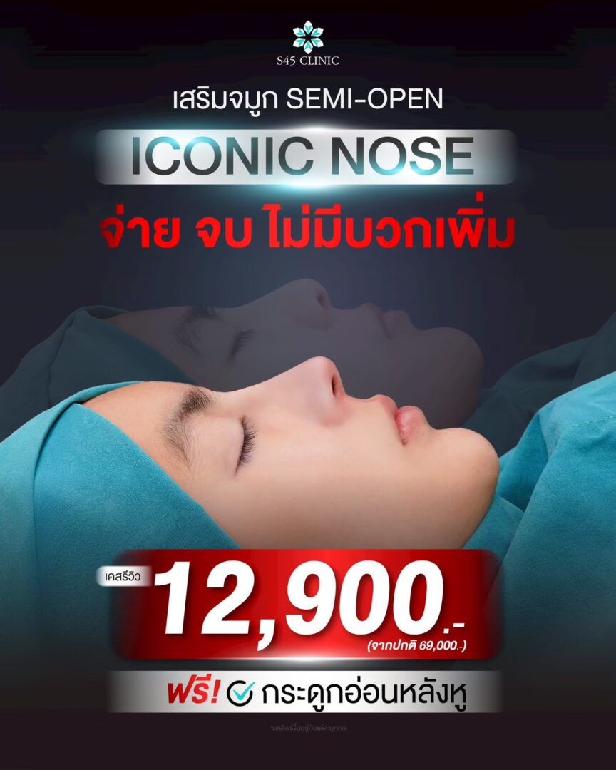 Promotion โปรโมชั่น เสริมจมูก แก้จมูก ราคาคุ้มค่า S45 Clinic จัดโปรให้ 5 โปรโมชั่นเสริมจมูก