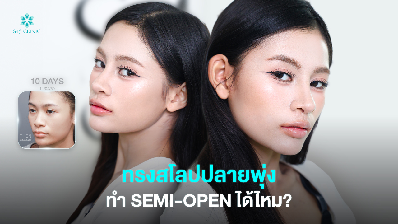 httpss45clinic comslope tip nose semi open rhinoplasty