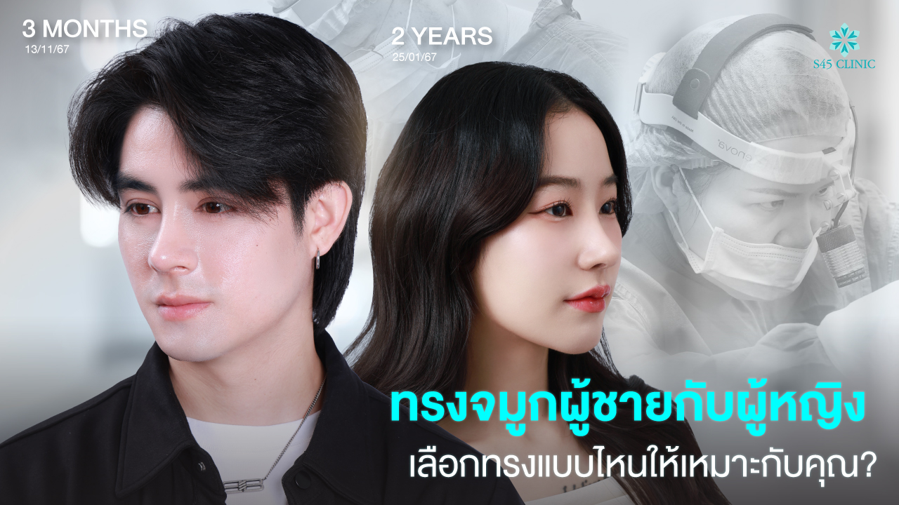 male female nose shape difference s45clinic
