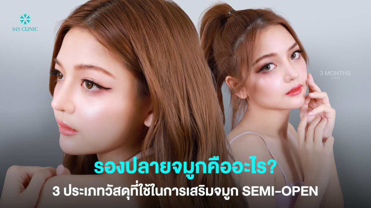 nose tip graft material semi open s45clinic