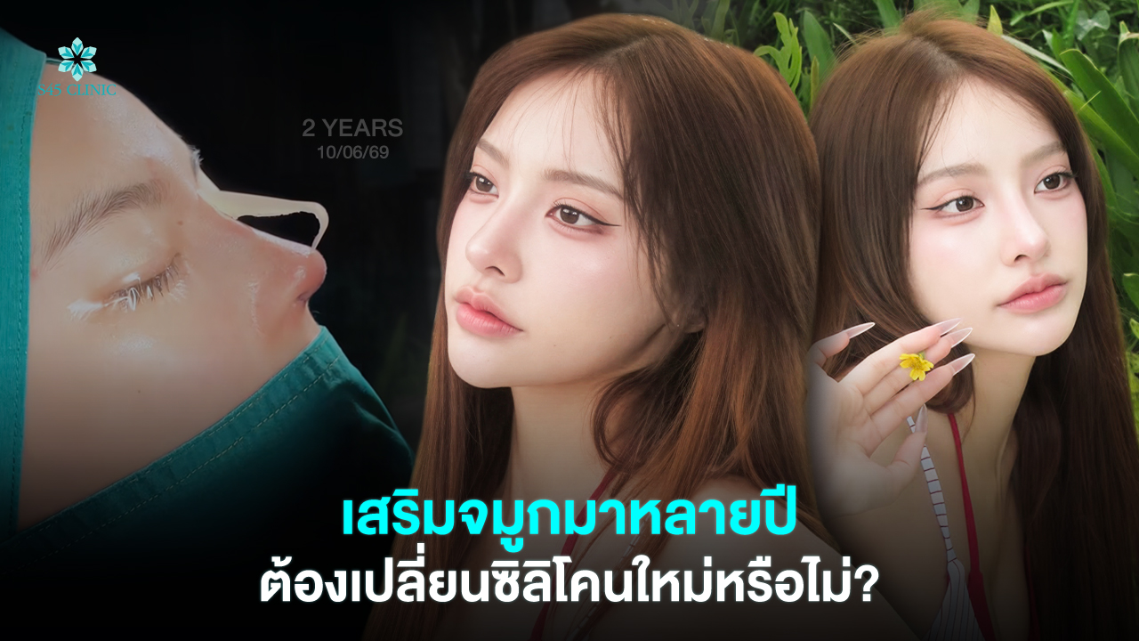 silicone nose expiry years after rhinoplasty s45clinic