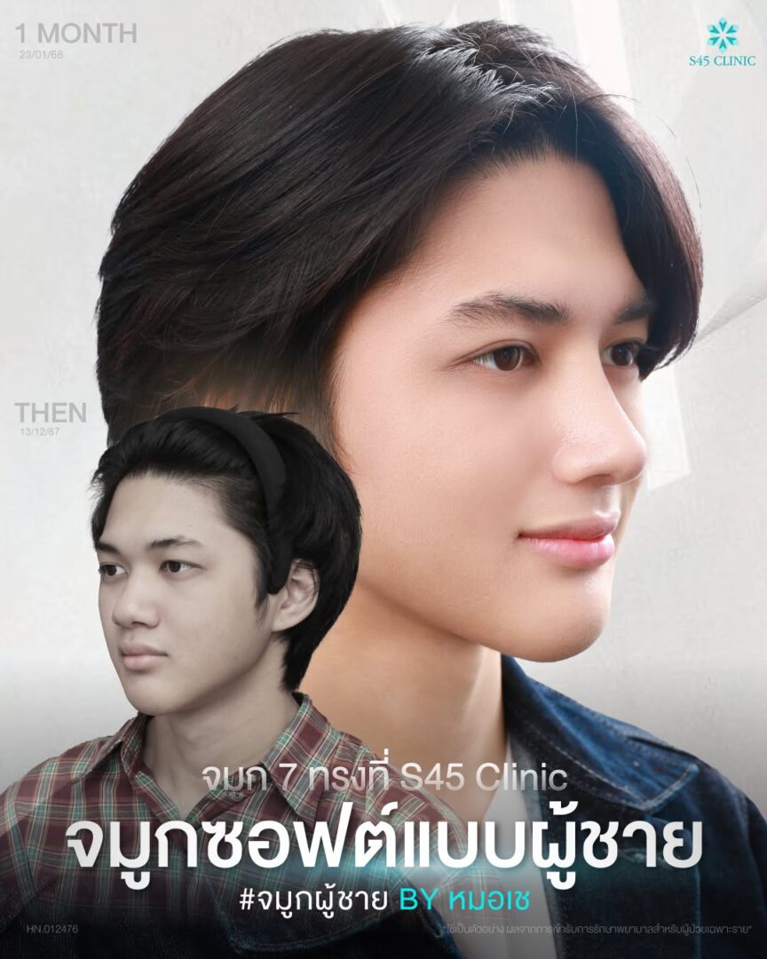 จมูกมีฮัมพ์