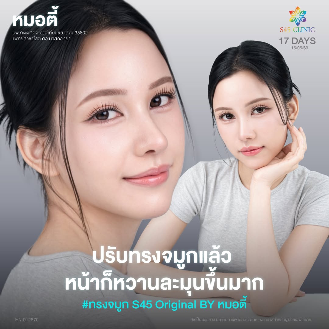 ทรงจมูก