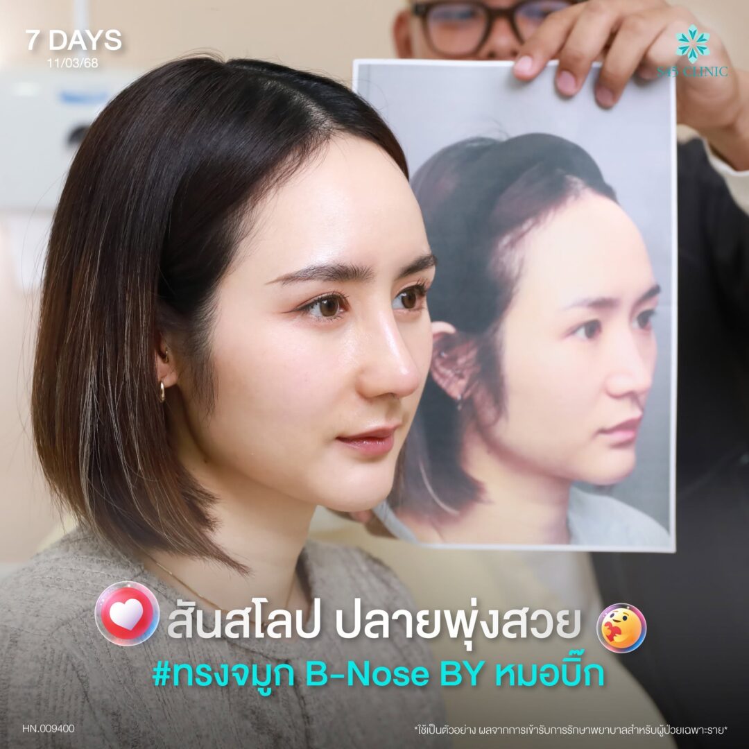 ทรงจมูกสโลปหวาน