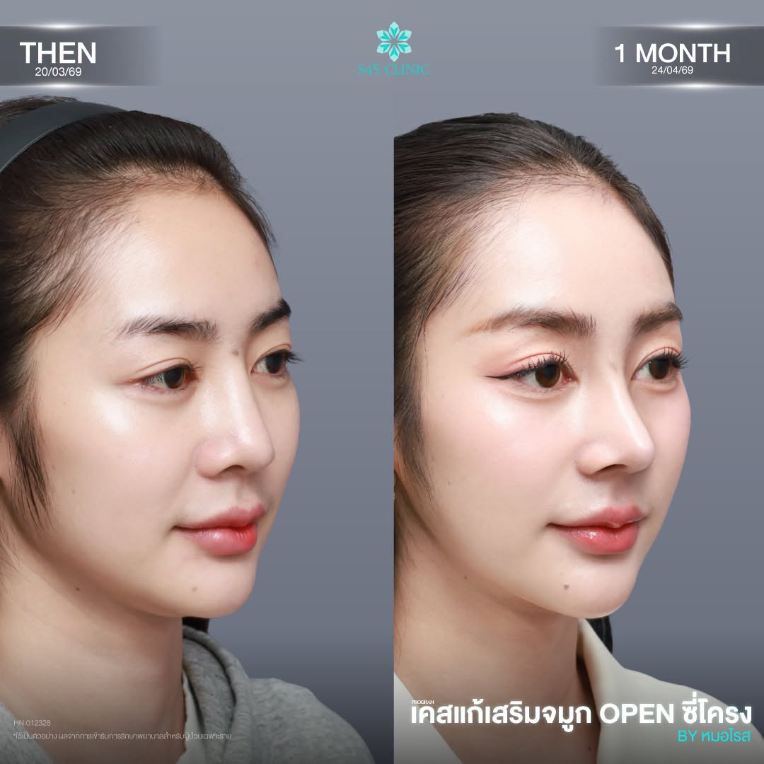 ทรงสโลปปลายพุ่ง ที่ไหนดี