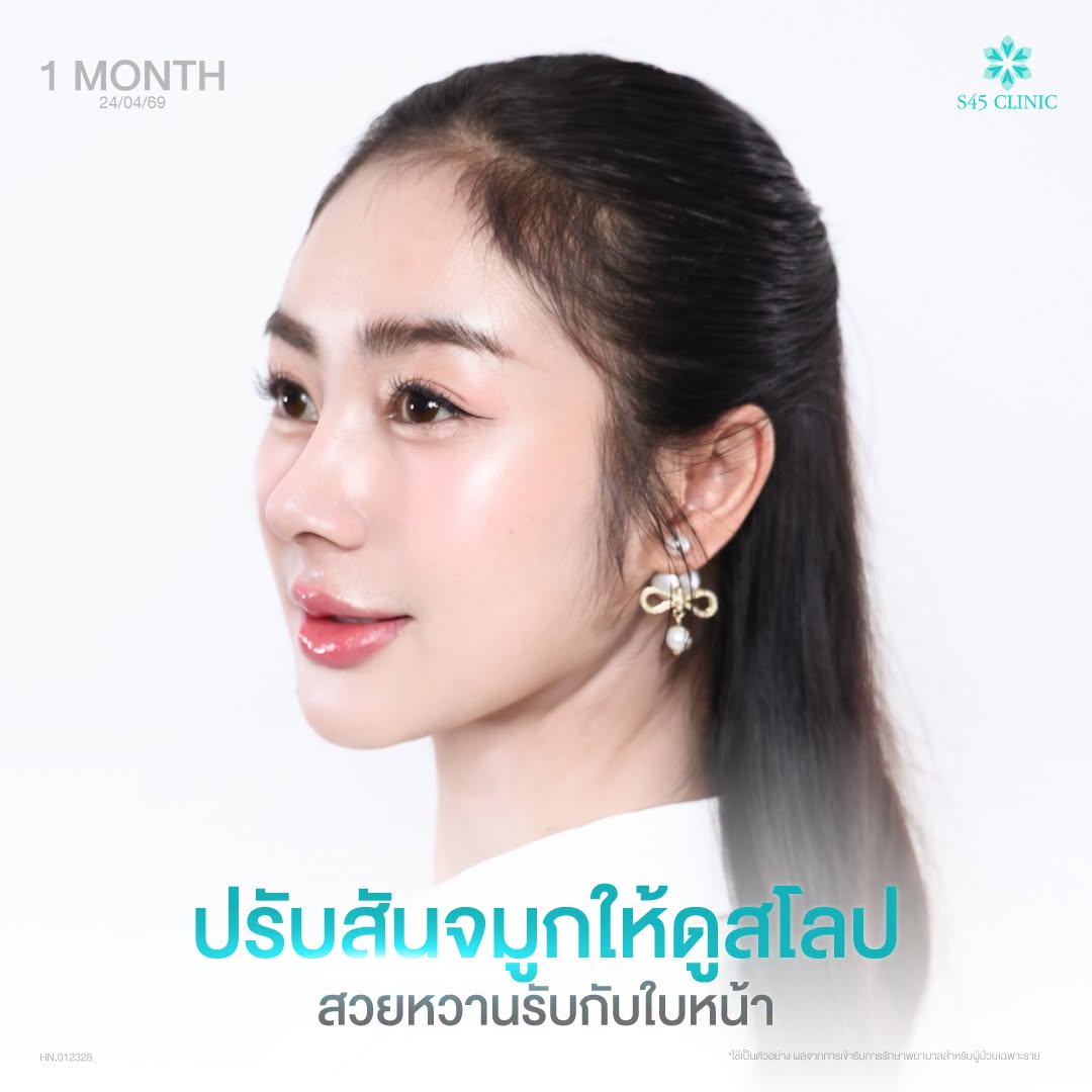 ทรงสโลปปลายพุ่ง