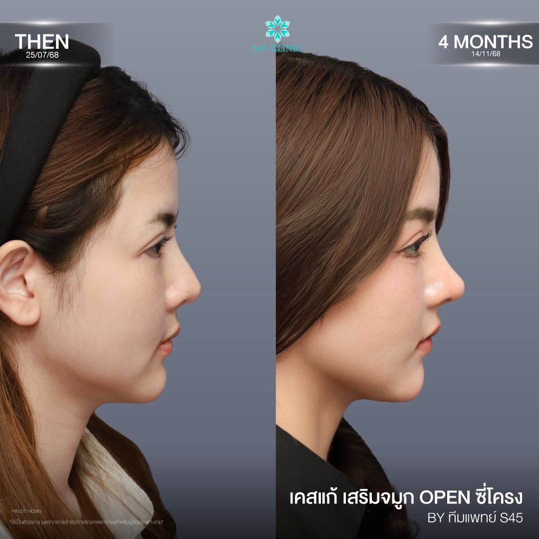 ทรงไม่รับกับใบหน้า