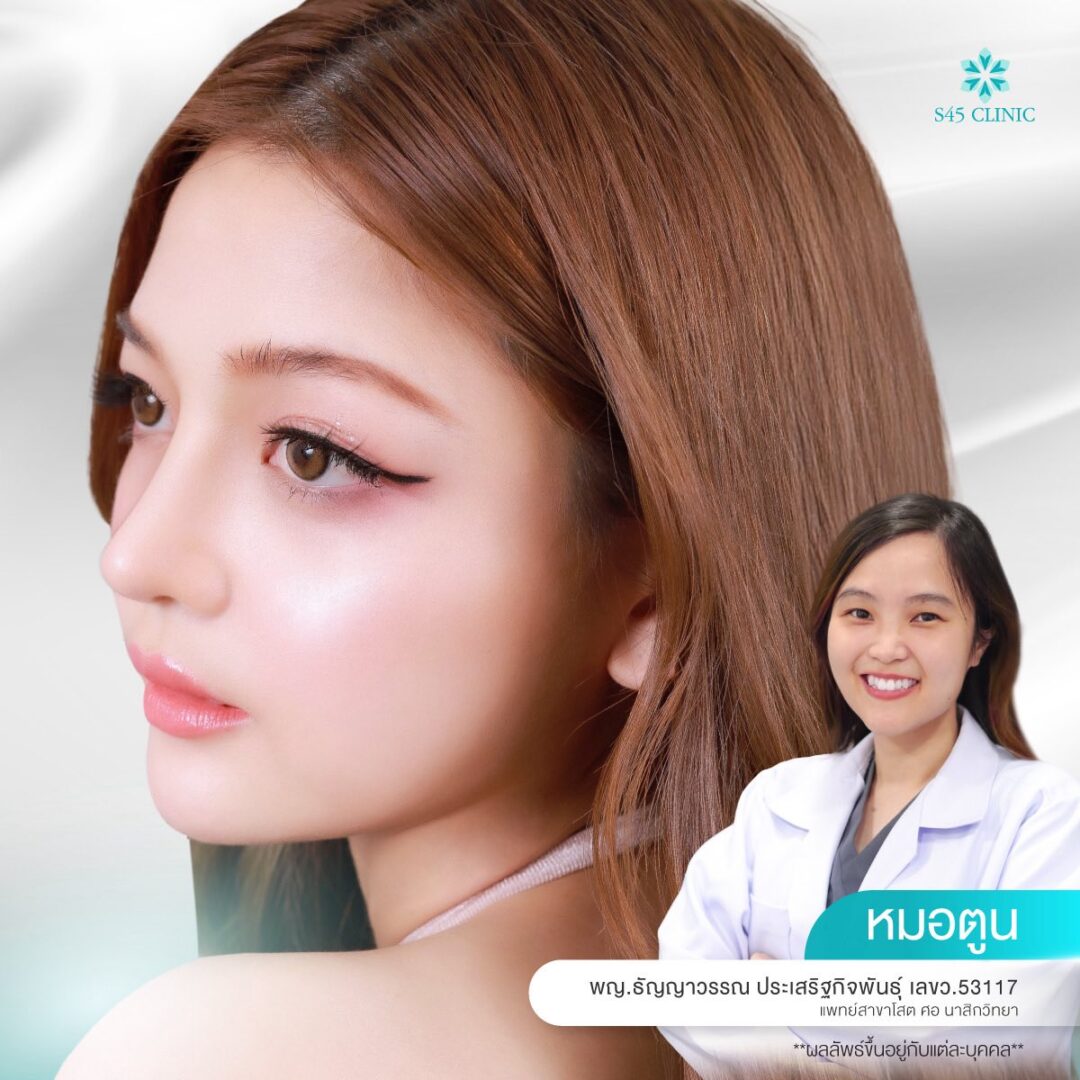 รองปลายจมูกคืออะไร? 3 วัสดุที่ใช้ในการเสริมจมูก Semi-Open 4 รองปลายจมูก