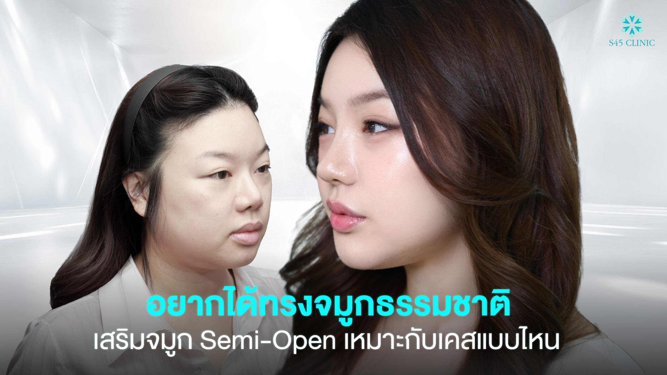 อยากได้ทรงจมูกธรรมชาติ