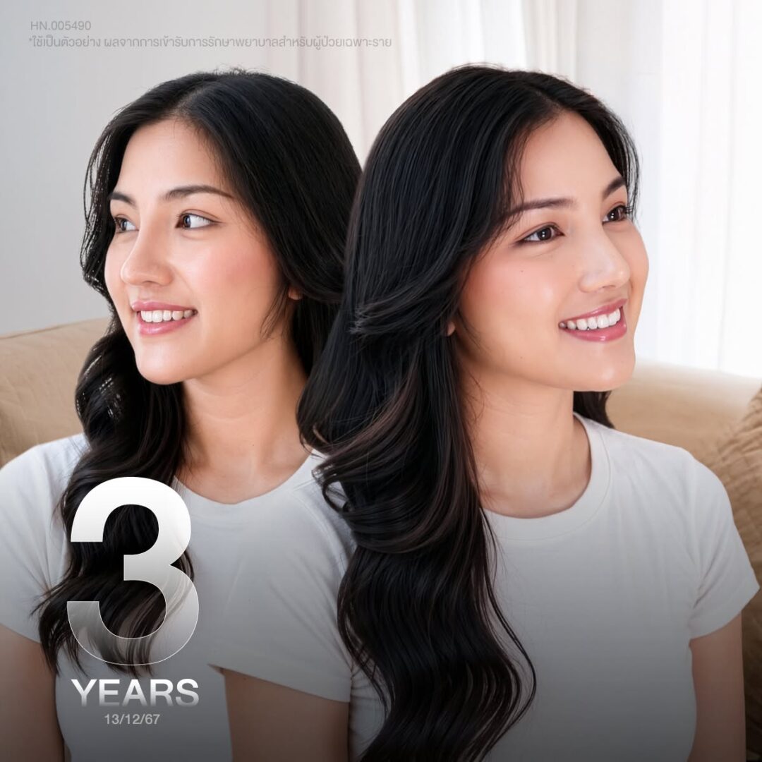 เสริมจมูก 3 ปี