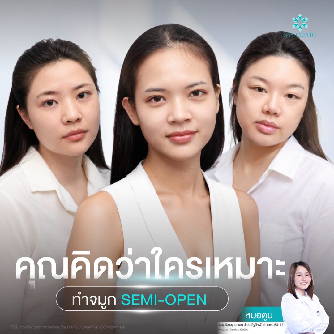 เสริมจมูก เหมาะกับใคร