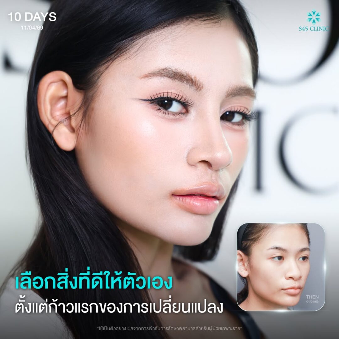 เสริมจมูกที่ไหนดี