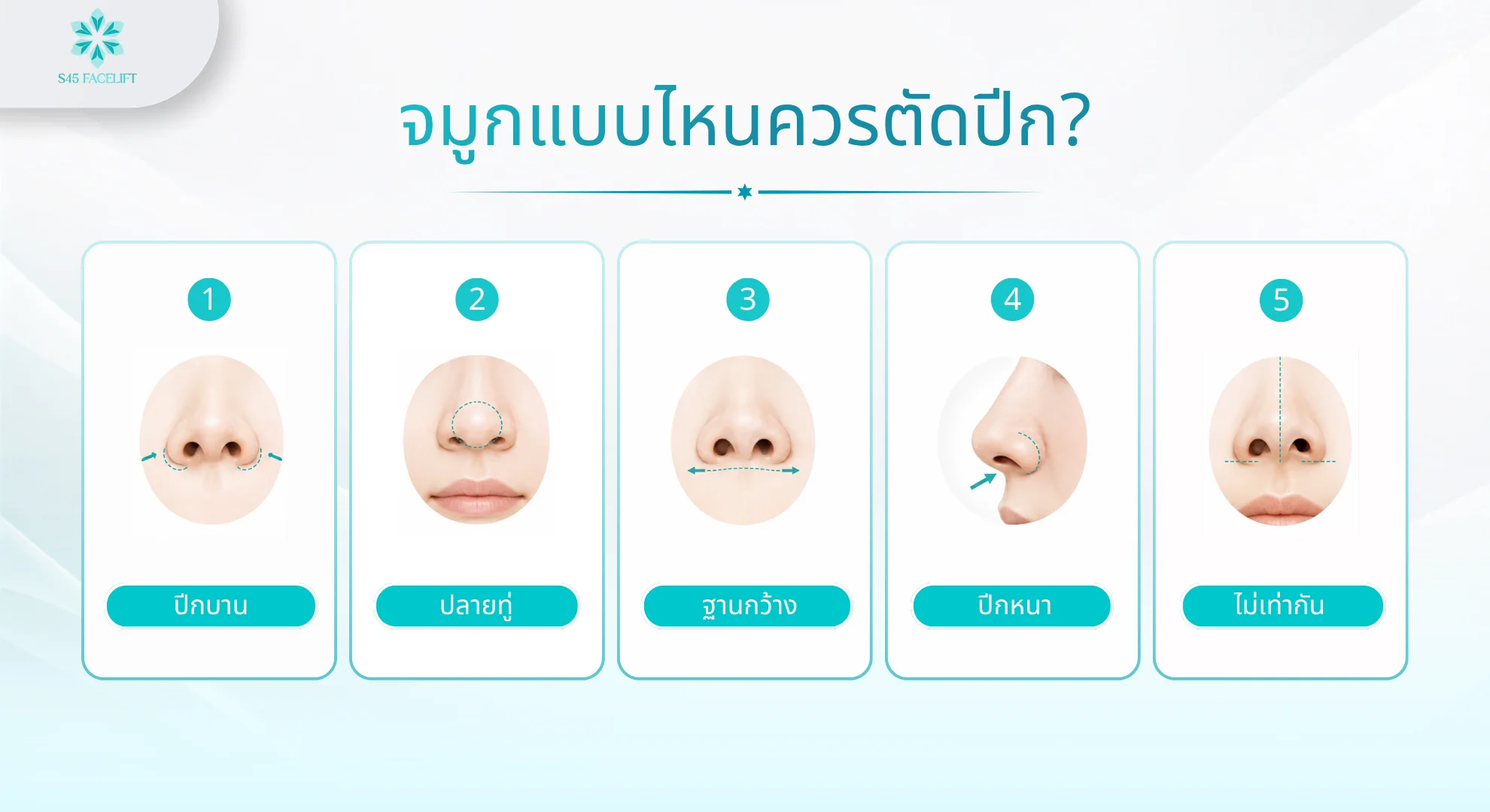 ตัดปีกจมูกที่ไหนดี จมูกแบบไหนควรตัดปีก