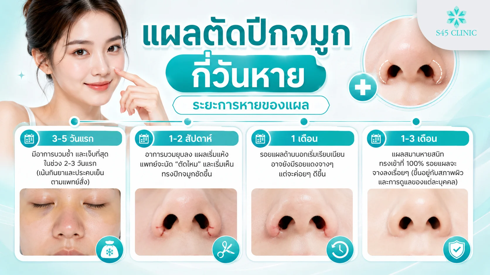 ระยะการหายของแผลตัดปีกจมูก ตั้งแต่บวมช้ำ ตัดไหม จนแผลเข้าที่