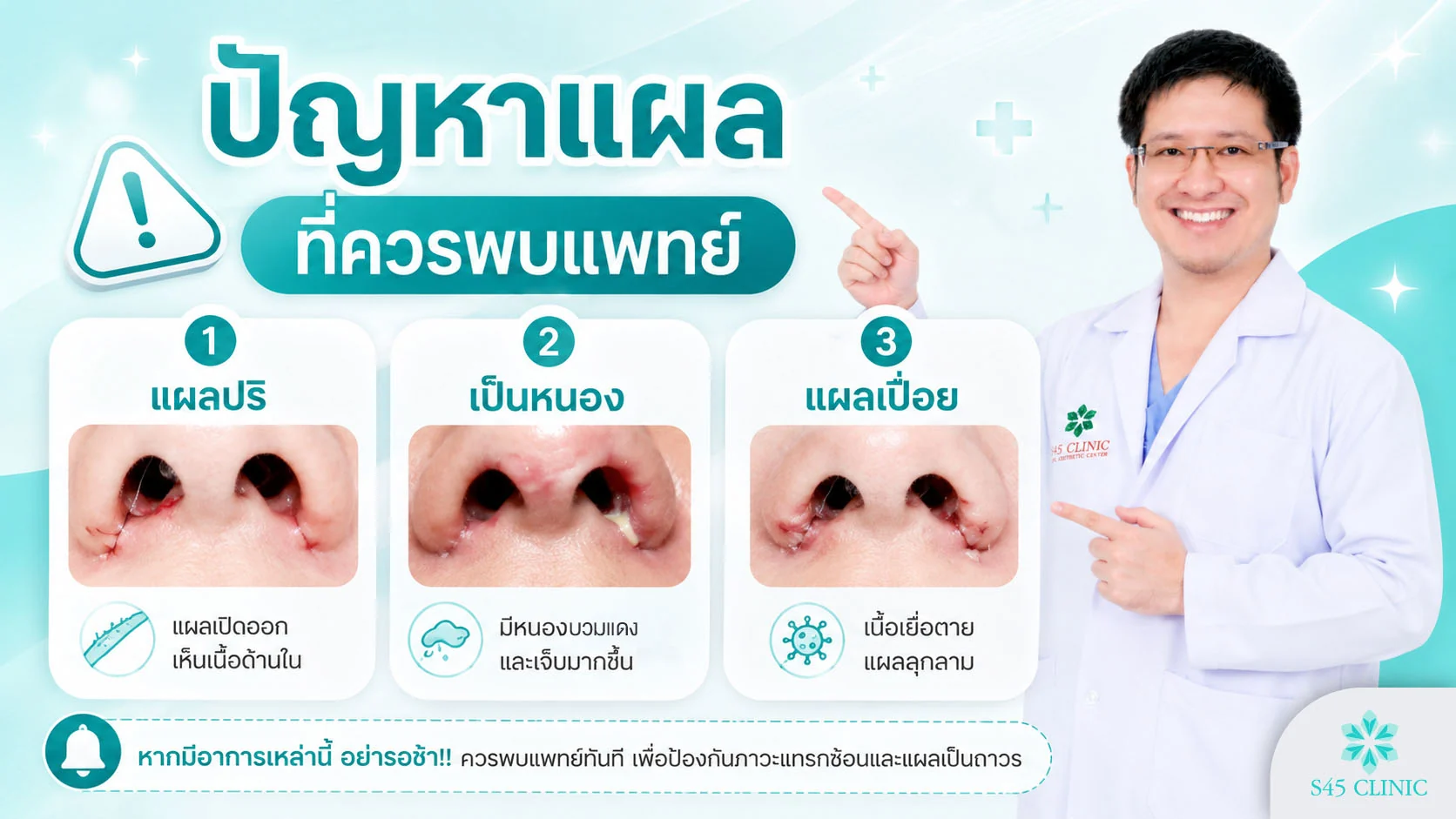 สัญญาณปัญหาแผลตัดปีกจมูกที่ควรพบแพทย์ แผลปริ เป็นหนอง เปื่อย