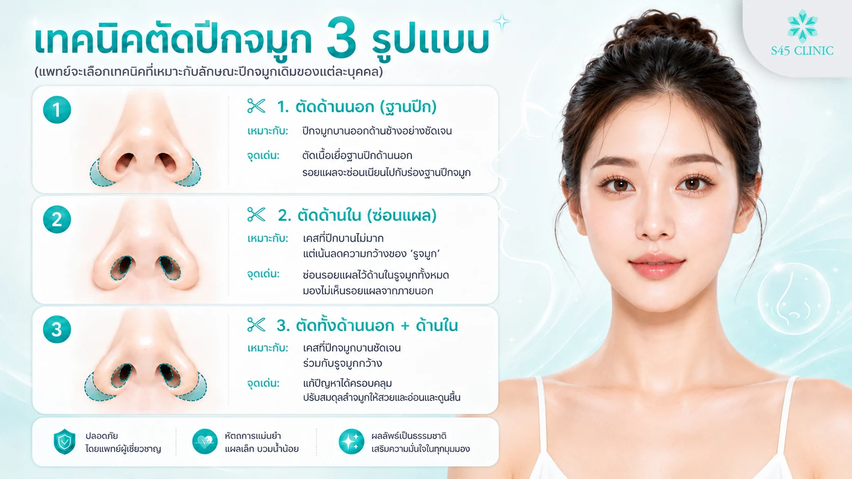 เทคนิคตัดปีกจมูก 3 รูปแบบ ตัดด้านนอก ตัดด้านใน และตัดทั้งด้านนอกและด้านใน