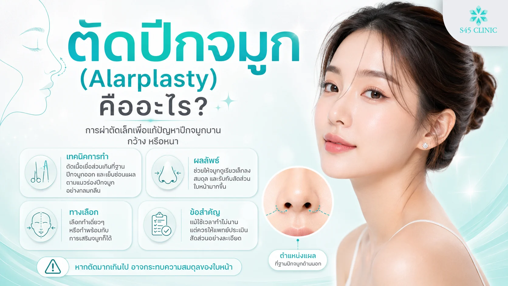 ตัดปีกจมูก (Alarplasty) คืออะไร ผ่าตัดเล็กปรับฐานปีกจมูกที่บานให้รับกับใบหน้า