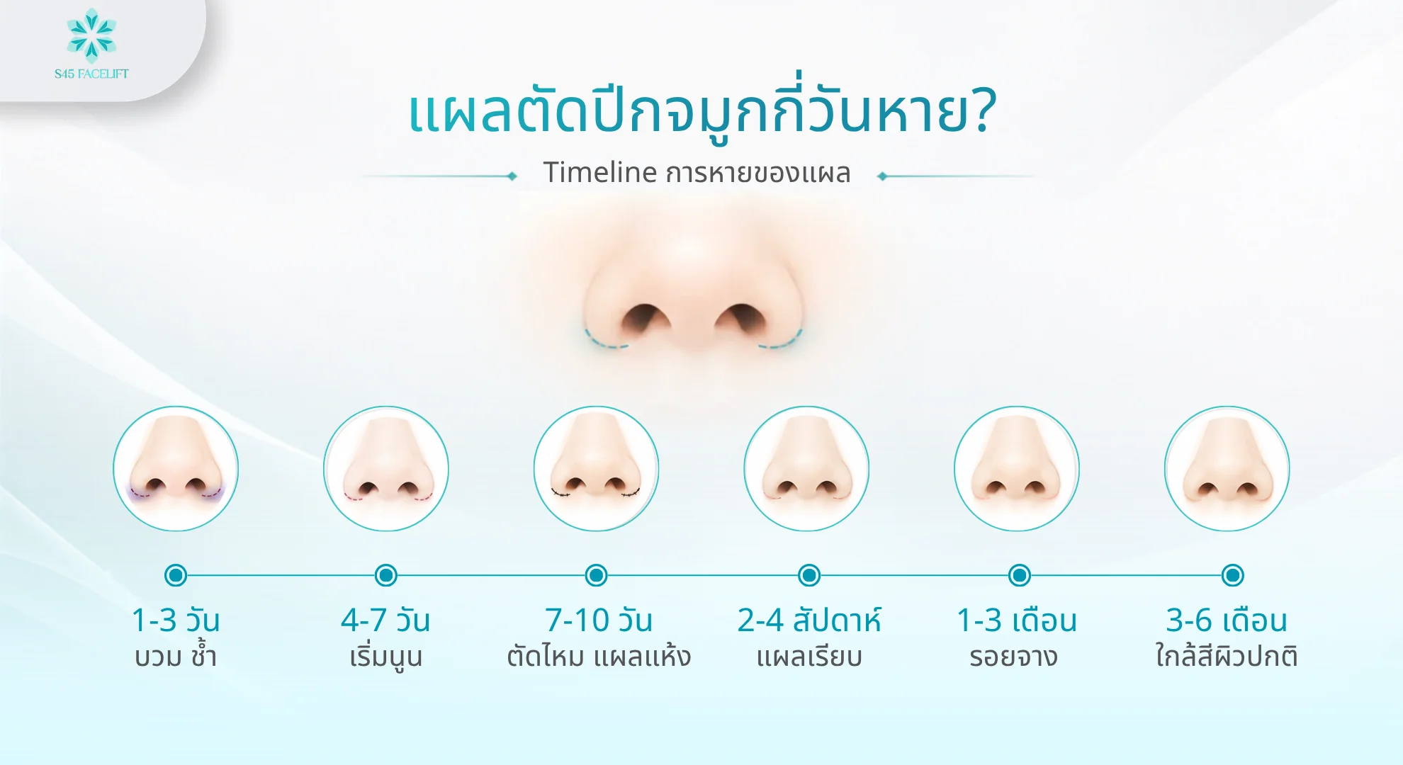 แผลตัดปีกจมูก Timeline แผลหาย