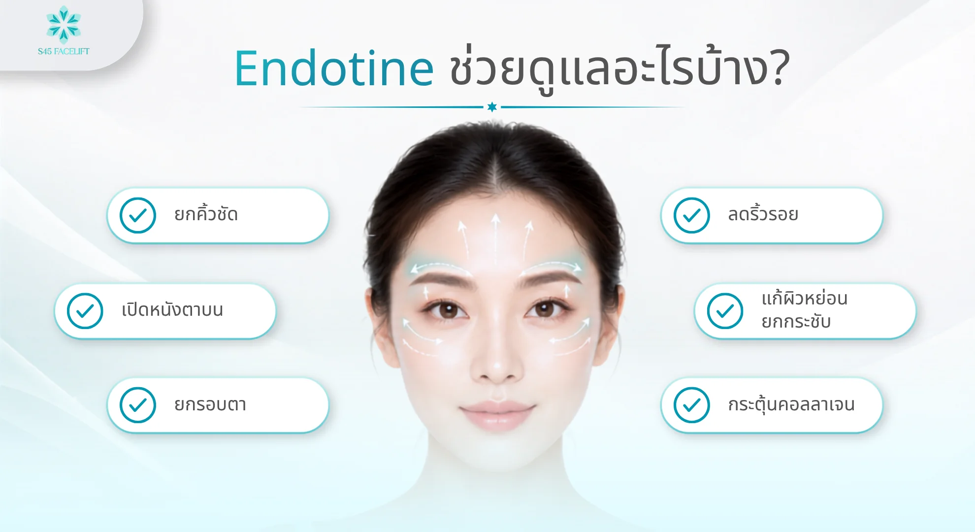 Endotine แก้ปัญหาการหย่อนคล้อยใบหน้าส่วนบนที่โบท็อกทำไม่ได้