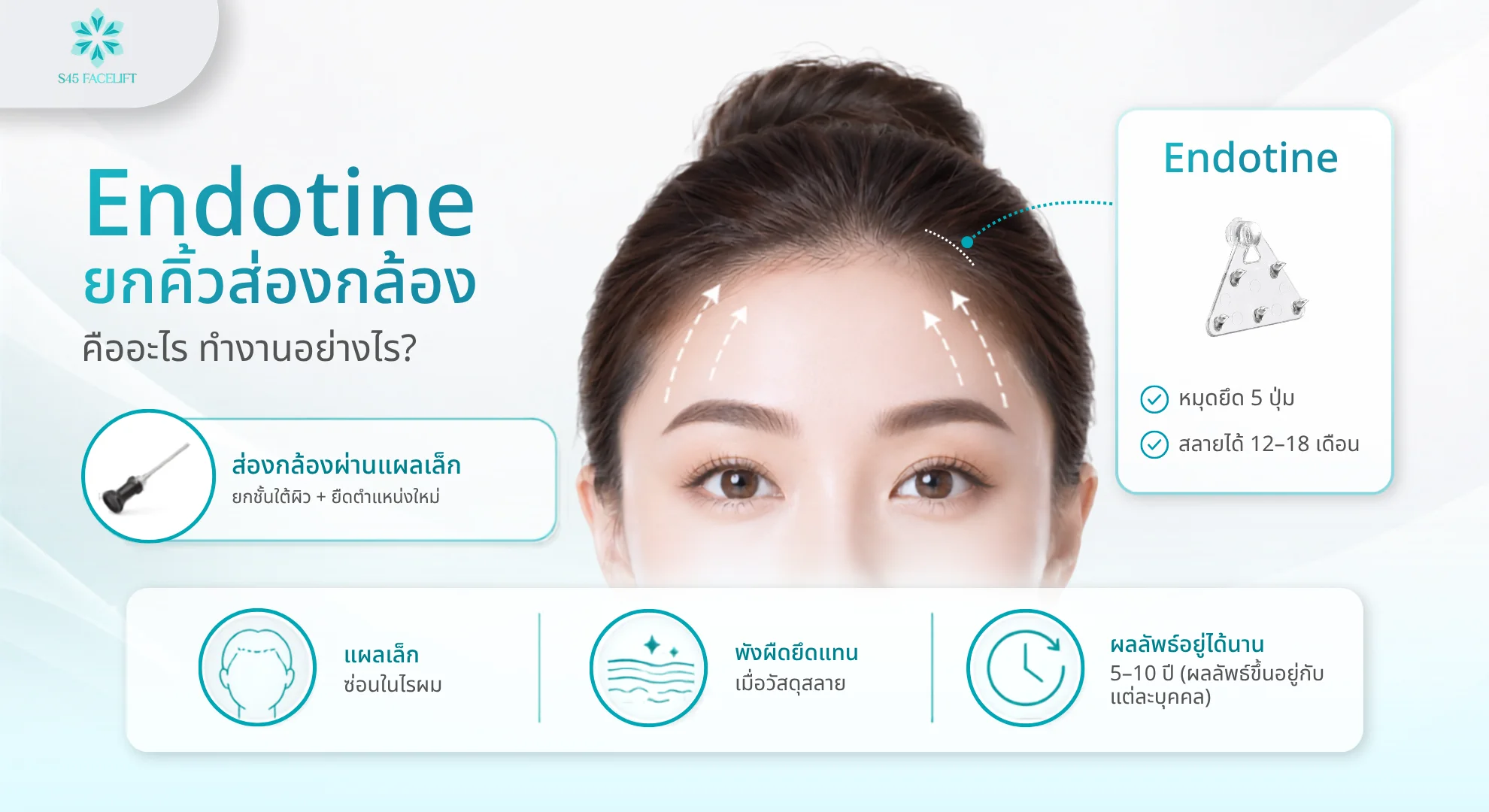 Endotine ยกคิ้วส่องกล้อง วัสดุยึดชั้นผิวลึกให้ผลลัพธ์ยาวนาน
