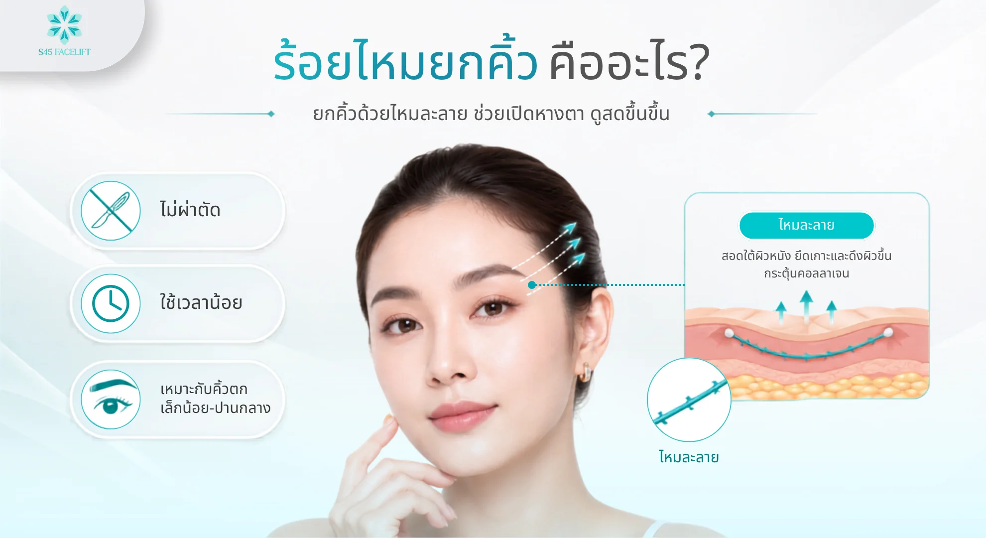 ร้อยไหมยกคิ้ว เทียบ ยกคิ้วส่องกล้อง Endotine