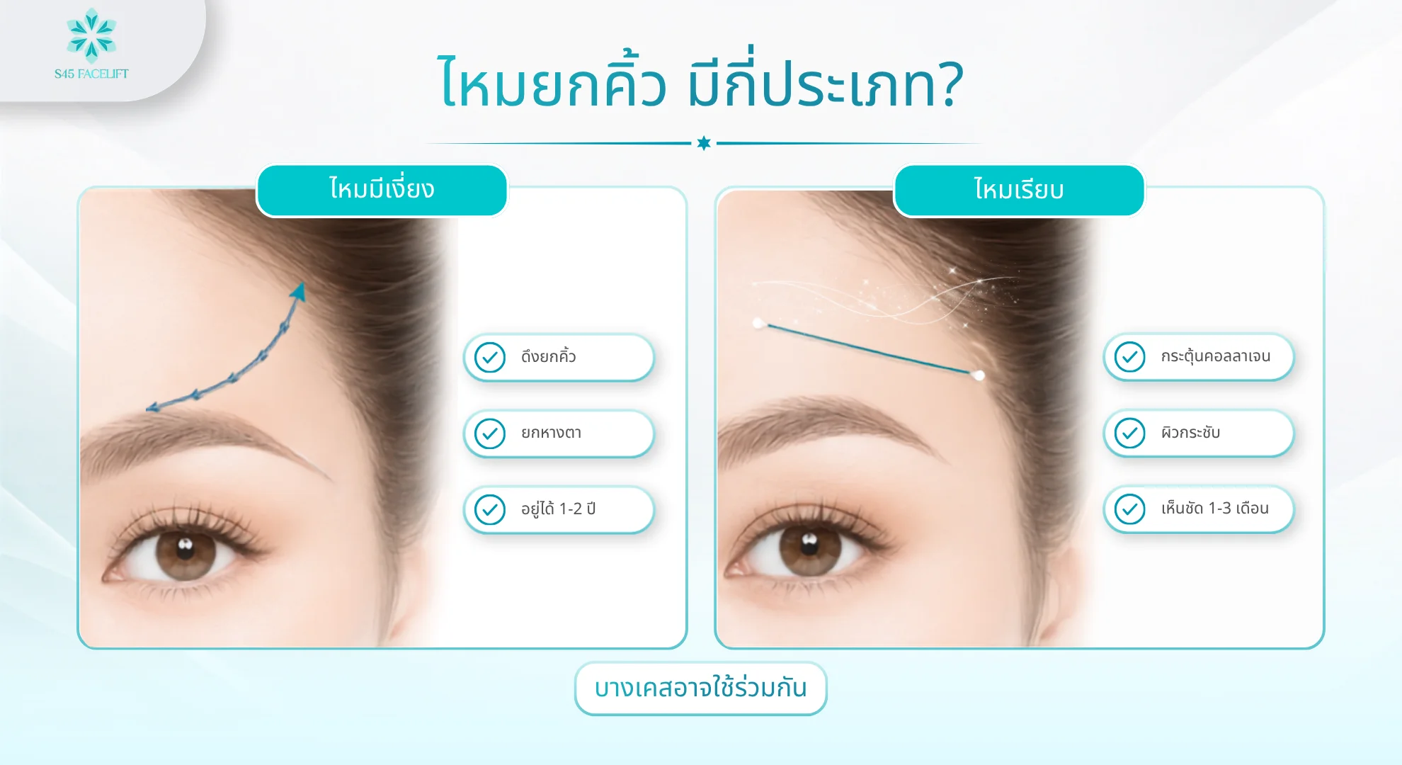 ชนิดของไหมที่ใช้ร้อยไหมยกคิ้ว ไหมมีเงี่ยงและไหมเรียบ