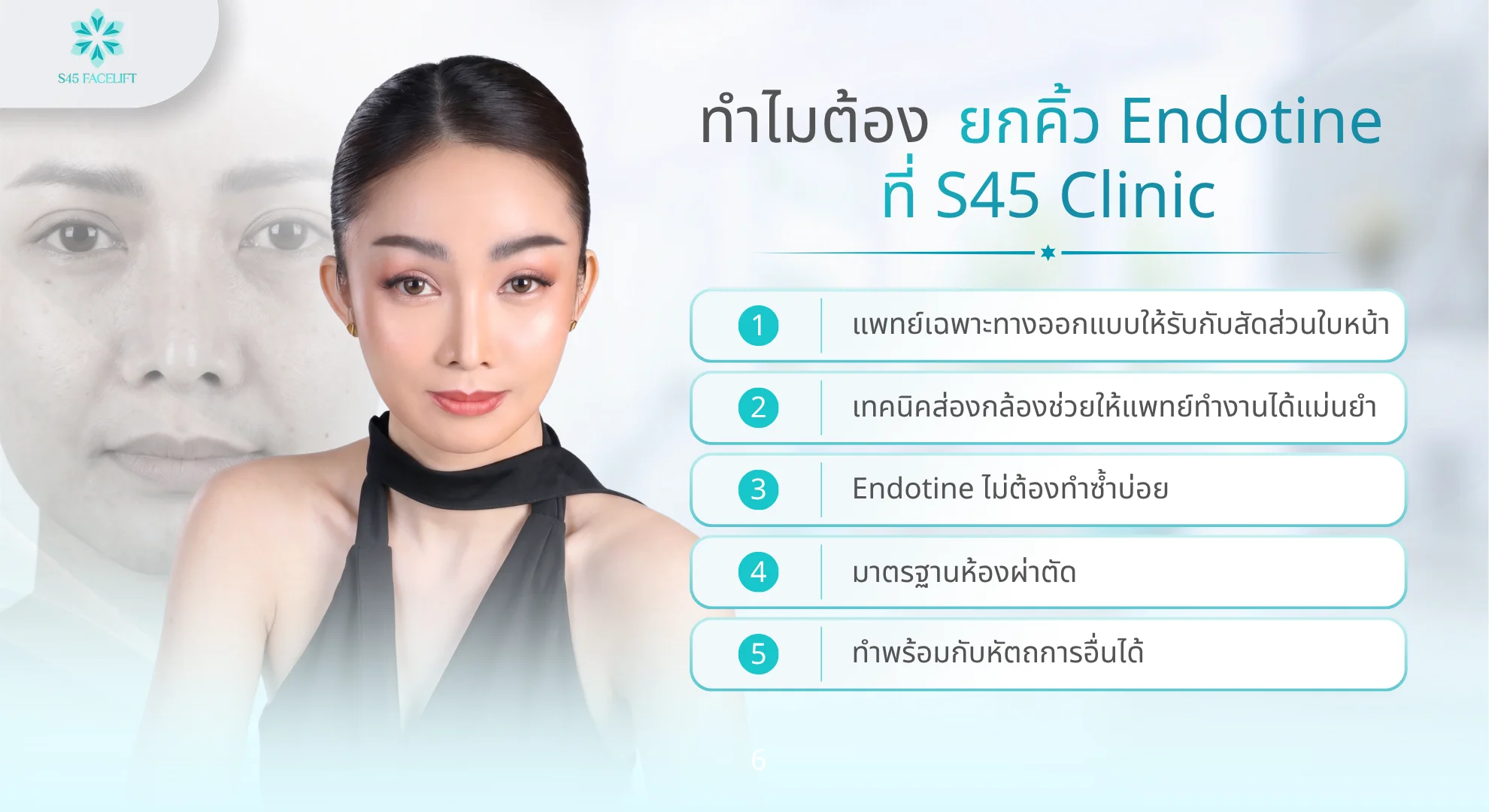 ยกคิ้วส่องกล้อง Endotine ที่ S45 Clinic