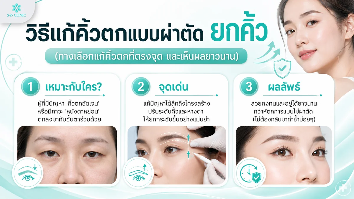 วิธีแก้คิ้วตกแบบผ่าตัดยกคิ้ว เหมาะกับเคสที่คิ้วตกชัด