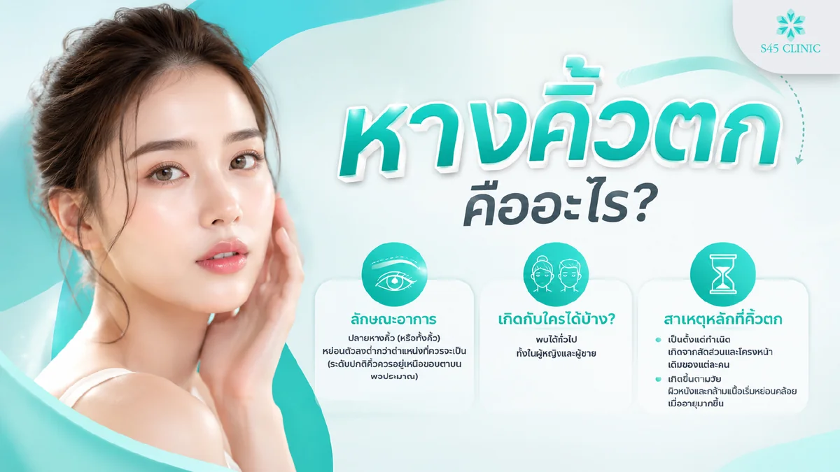 ลักษณะหางคิ้วตก ตำแหน่งหางคิ้วอยู่ต่ำกว่าปกติ