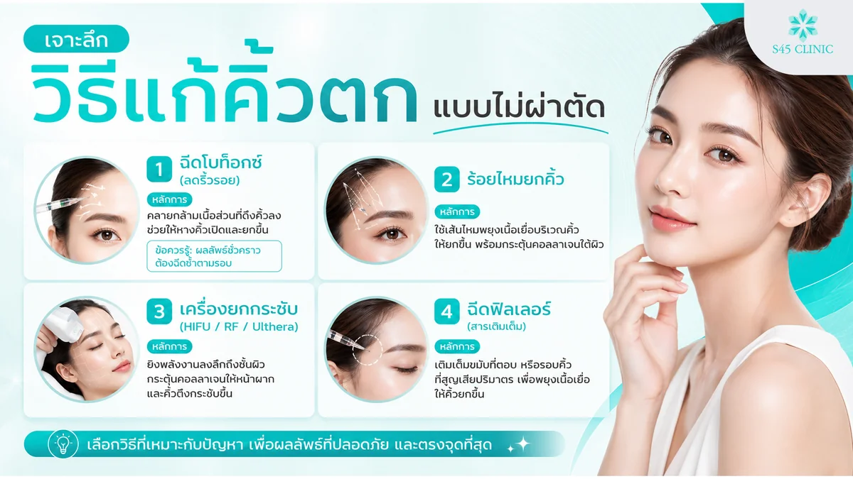 เปรียบเทียบวิธีแก้คิ้วตกแบบไม่ผ่าตัด ฉีดลดริ้วรอย ร้อยไหม พลังงาน และฉีดสารเติมเต็ม