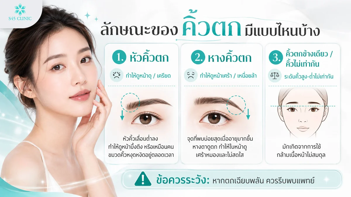 ลักษณะคิ้วตก 3 แบบ หัวคิ้วตก หางคิ้วตก และคิ้วตกข้างเดียว