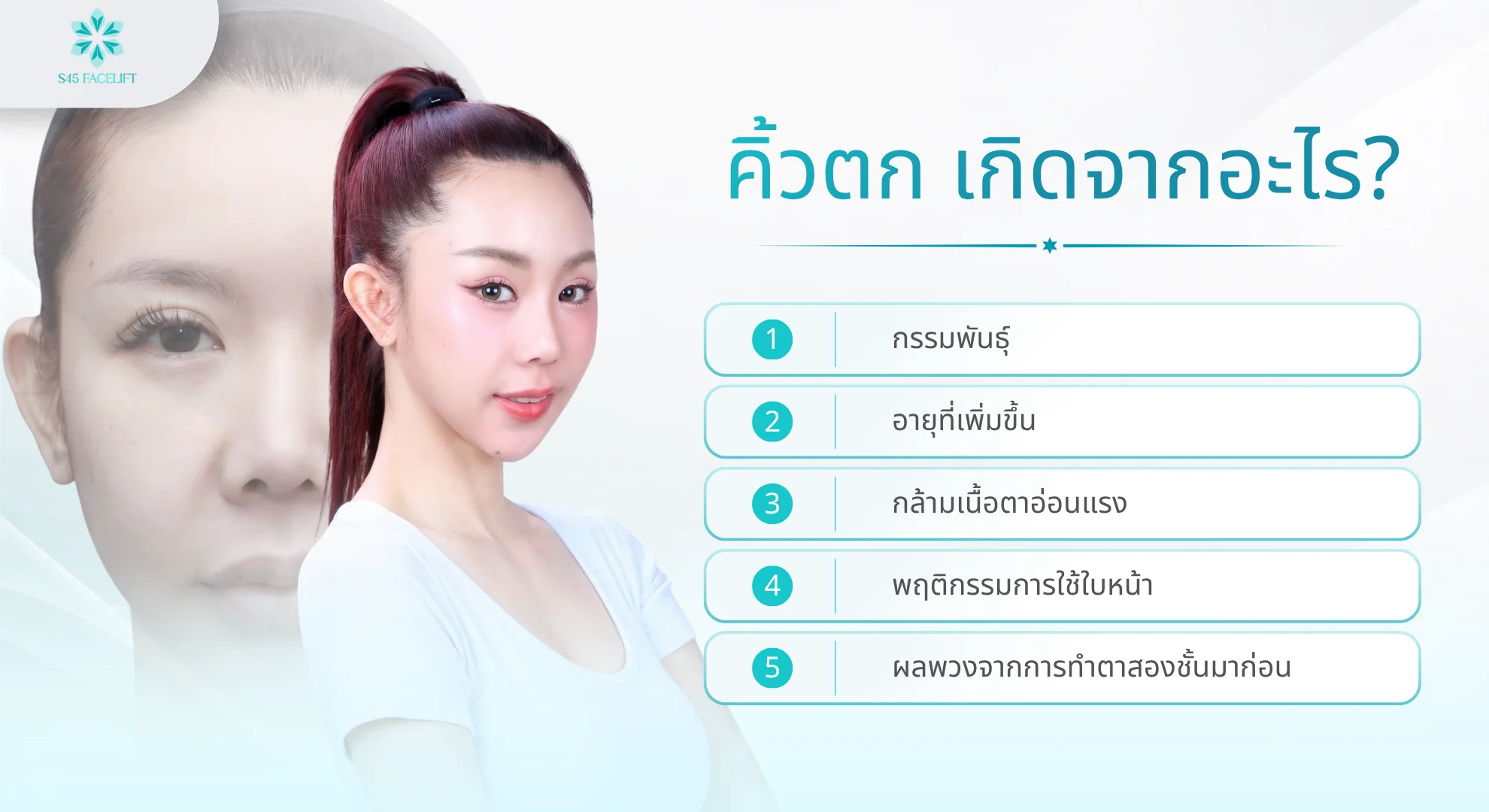 5 สาเหตุของคิ้วตก กรรมพันธุ์ อายุ กล้ามเนื้อตาอ่อนแรง พฤติกรรม และผลจากการทำตาสองชั้น