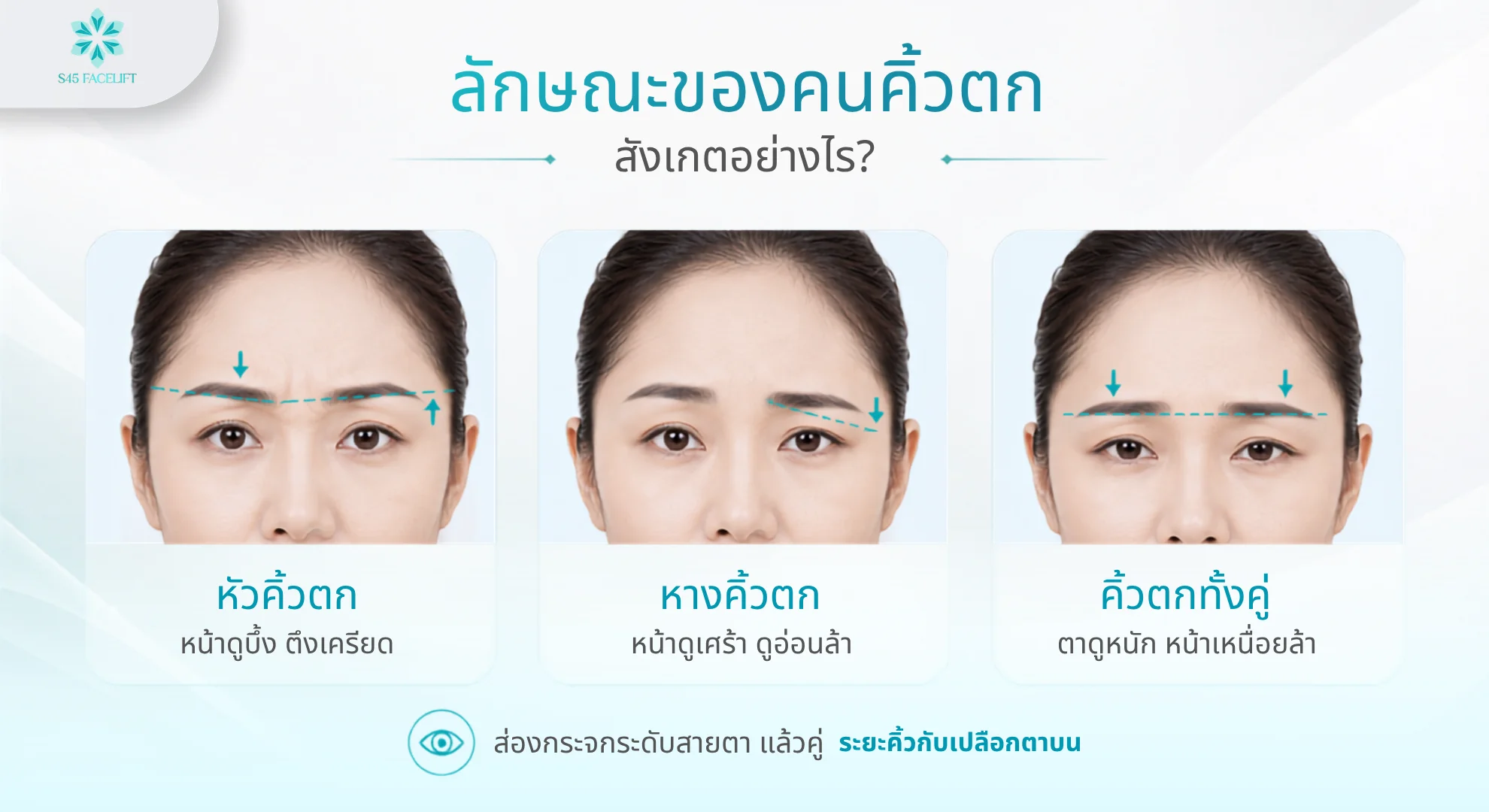 3 รูปแบบของคนคิ้วตก หัวคิ้วตก หางคิ้วตก และคิ้วตกทั้งคู่
