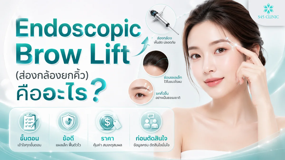 Endoscopic Brow Lift ส่องกล้องยกคิ้ว คืออะไร ขั้นตอน ข้อดี ราคา