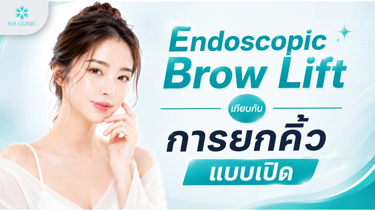 เปรียบเทียบ Endoscopic Brow Lift กับการยกคิ้วแบบเปิด