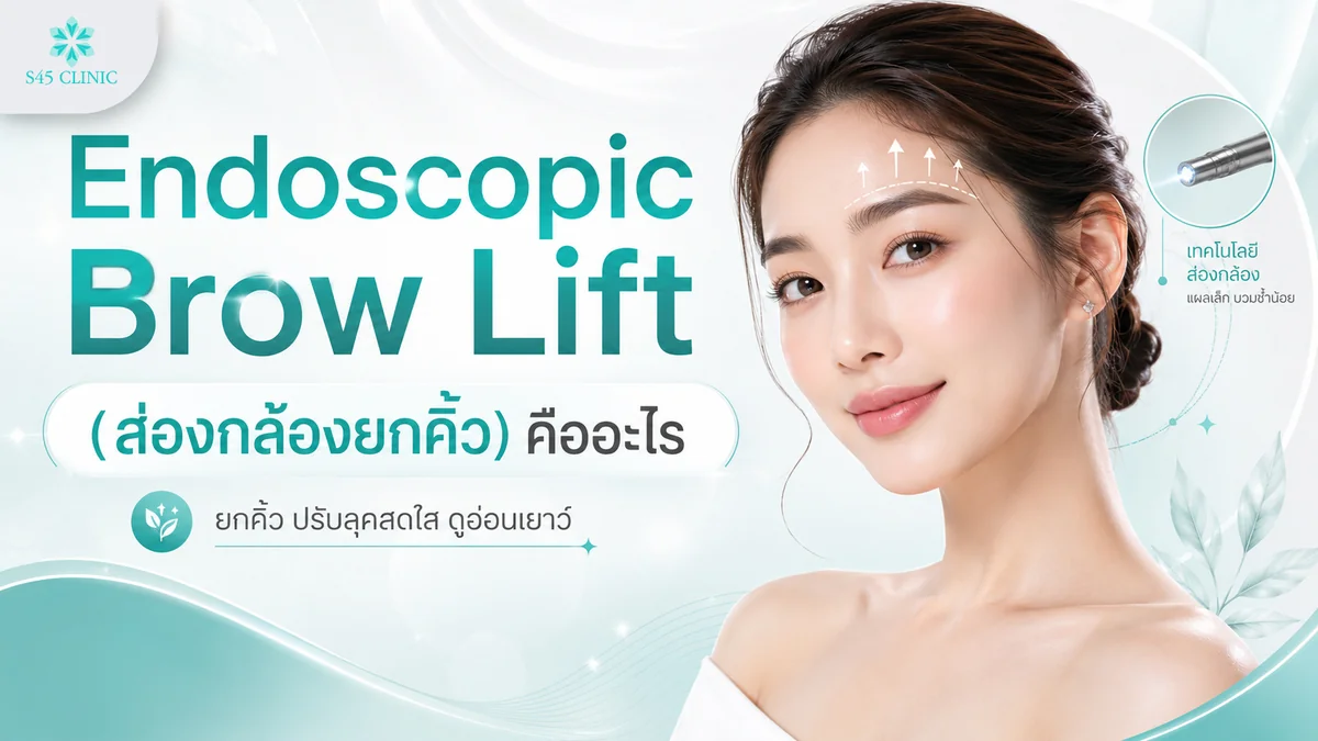 Endoscopic Brow Lift ส่องกล้องยกคิ้ว ผ่านแผลเล็กในแนวไรผม